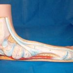 مقاله در مورد صافی کف پا (علل، علائم، تشخیص و درمان)